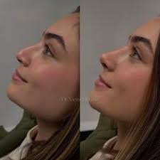 Daniela Rangel Acosta (dara08rsl)