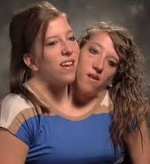 They are highly symmetric, giving the appearance of having just a single body with. Hygo Videos Abby And Brittany Conjoined Twins Facebook