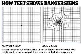 Eyes Vision Eye Vision Grid