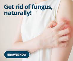 18 Simple Home Remedies For Fungal Infections! - Pharmeasy Blog