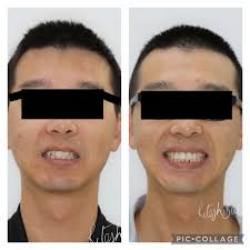 10 BEST Denture Clinics in Wollongong NSW