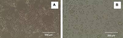 A cell line derived from the kidney of the african green (vervet) monkey, (cercopithecus aethiops) used primarily in virus replication studies and plaque assays. Development Of Suspension Adapted Vero Cell Culture Process Technology For Production Of Viral Vaccines Sciencedirect