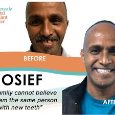 TOP 10 BEST Dental Lab near San Carlos, CA