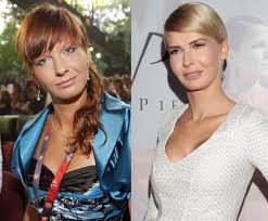 Tym razem chodzi o publikacje, w których sugerowano, że żona cezarego pazury poprawiała urodę za pomocą chirurgii plastycznej. Edyta Pazura Pozywa Tabloid Za Nieprawdziwe Informacje O Operacjach Plastycznych Pudelek