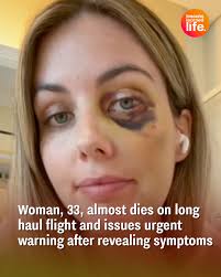 She was perfectly healthy but it's a 'miracle' she's alive 😯