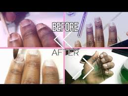 Acrylic nails have been around for decades, but they've had a resurgence in recent years thanks to a combination of celebs, instagram, and our collective nail art obsession. How To Diy Acrylic Nails For Short Bitten Nails Fix Short Bitten Nails Youtube