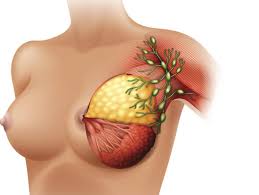 It is more common in older men but can occur at any age. Breast Lumps Causes Types Checking And Treatment