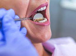 Home Remedies For Abscess Tooth: 10 Remedies For Swelling And Pain