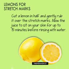 Learn How To Get Rid Of Stretch Marks With Home Remedies That Will Help To Improve The Appear Stretch Mark Remedies Stretch Marks Remedies For Menstrual Cramps