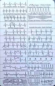 Ecg Highlights Nursing School Notes Oncology Nursing Nursing School Tips