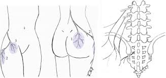 Maybe you would like to learn more about one of these? Rehabilitative Principles In The Management Of Thoracolumbar Syndrome A Case Report Abstract Europe Pmc