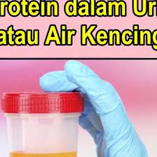 Keluasan kehadiran protein dalam air kencing, yang juga dikenali sebagai proteinuria , adalah keadaan perubatan yang berlaku apabila terdapat peningkatan perkumuhan protein buah pinggang. Bacaan Normal Protein Dalam Air Kencing Malaycece