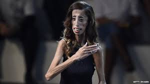 Top 10 ugliest girls in the world. Lizzie Velasquez Online Bullies Called Me The World S Ugliest Woman Bbc News