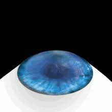 Went to major university eye institute. Lasik Wikipedia