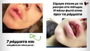 We did not find results for: Anna Maria Bellh Atyxhma Me 7 Rammata Sto Proswpo Kai Ena Spasmeno Donti Eikones