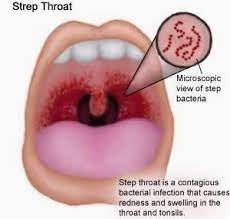 How To Do A Colon Cleanse Home Remedies For Strep Natural Home Remedies Herbal Remedies
