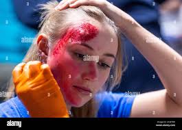 One attack is one attack