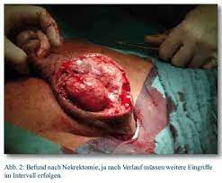 Maybe you would like to learn more about one of these? Fournische Gangran Gestern Und Heute Fachportal Fur Wehrmedizin Wehrpharmazie