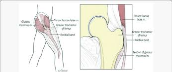 Image result for Snapping Hip