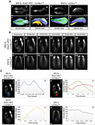 View the profiles of people named ana paula arichavala arias. A Tgfbr1 Snai1 Dependent Developmental Module At The Core Of Vertebrate Axial Elongation Elife