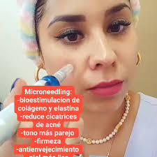 Roxana Salinas (@ciellamedicinaesteticamx) • Instagram photos and videos