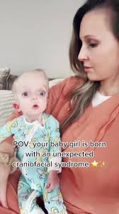 Being brown with a rare genetic syndrome that affects your appearance sure  makes ya girl ✨popular ✨ But I mean , man, is she adorable or what 😍  #popular #pfeiffersyndrome #craniowarrior💜 #caliscrew ...