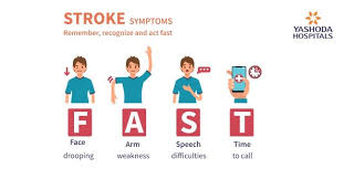 An iv injection of recombinant tissue plasminogen activator (tpa) — also called alteplase (activase) — is the gold standard treatment for ischemic stroke. Brain Stroke Symptoms Types Risk Factors Diagnosis And Treatment