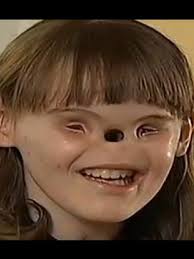 Cassidy HOOPER y su caso increíble #medicina #casomedico #sindrome #terror  #historiadevida #cassidy #hooper