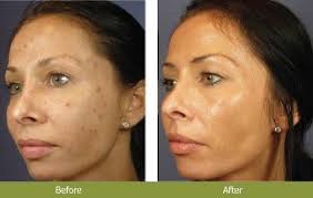Ageless is full of professional, friendly, and knowledgeable staff. Facial Treatments