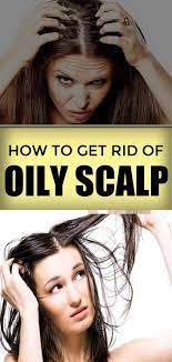 How To Get Rid Of Oily Scalp Greasy Hair Home Remedies Oilyscalp Oilyhair Greasyhair Homeremedies Greasy Hair Hairstyles Greasy Hair Remedies Oily Scalp