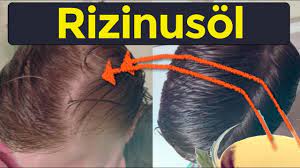 Moderne haartransplantation führt zu natürlichen ergebnissen. Wie Man Kahlheit Mit Rizinusol Verhindert Stoppt Haarausfall Mit Rizinusol Youtube