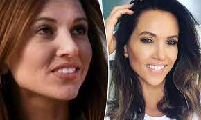 She got married to cricketer michael clarke in 2012 and welcomed her first. Sydney Plastic Surgeon Speculates On Wag Kyly Clarkec Changing Look Daily Mail Online