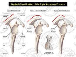 Es una protuberancia ancha que sobresale en forma de paleta. Bigliani Classification Of The Right Acromion Process