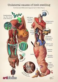 Pin On Medical