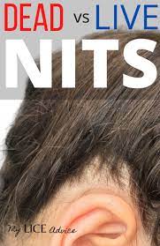 Dead Vs Live Nits Color Of Lice Eggs Lice Eggs Hair Nits Hair Growing Tips