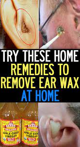Natural Home Remedies To Remove Ear Wax At Home Quick Look Natural Ear Infection Remedy Ear Wax Ear Infection Remedy