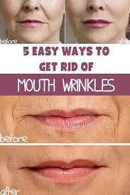 Medyx.will.fix On Twitter | Mouth Wrinkles, Facial Oil, Sagging Skin