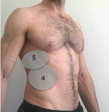 Check spelling or type a new query. Us Of Right Upper Quadrant Pain In The Emergency Department Diagnosing Beyond Gallbladder And Biliary Disease Radiographics