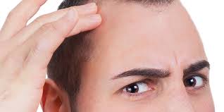 So common that scientists and medical professionals are putting all efforts towards effective hair loss procedures to help combat. Temple Hair Loss Causes And Treatment Options For Males Females