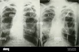 Image result for Point of Maximum Impulse