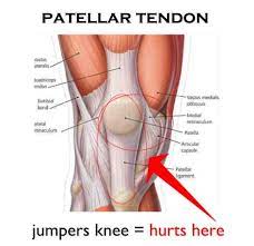 Subluxation Zum 2 Mal Knie Orthopade Knorpel