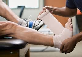 Fastnachtsveranstaltung bei den jakobinern in mainz. Achillessehnenriss Die Techniker