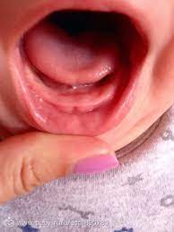 Maybe you would like to learn more about one of these? Zuby Chto Skazhete Zdorove I Pitanie Malysha