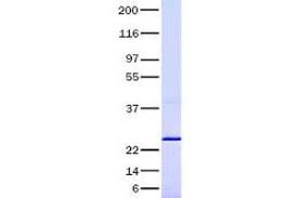 A scientist has warned the government around the world that the beta variant, which is quickly spreading through france, may be able to evade covid vaccines. Active Human Transforming Growth Factor Beta 2 Tgfb2 Protein Recombinant Abin2733497