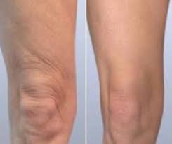 Pin On Walking Weight