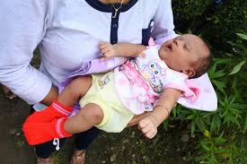 Metode yang kami lakukan pada sunat bayi agar tidak sakit tidak melakukan suntik. Sunat Bayi Sebaiknya Dilakukan Sebelum Usia 40 Hari Ini Alasan Dokter Theasianparent Indonesia