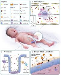 Image result for Neonatal Sepsis
