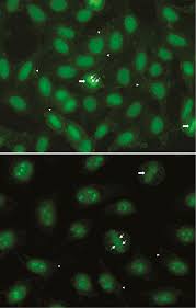 Image result for ANA Staining Pattern