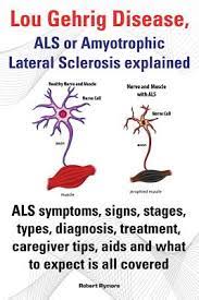 Lou Gehrig Disease Als Or Amyotrophic Lateral Sclerosis Explained Als Symptoms Signs Stages Types Diagnosis Treatment Caregiver Tips Aids And