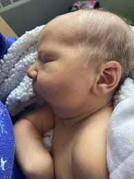 My NICU guy with Pierre Robin Sequence/cleft palate- 2 days old, 10 days,  14 weeks. The difference a couple months makes! : r/NICUParents